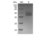 Recombinant Mouse IL-21R Protein (His Tag)