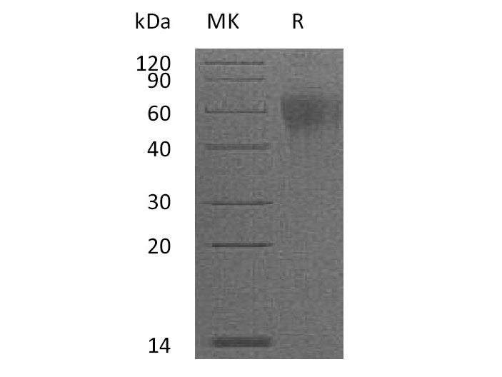 Recombinant Mouse IL-2RG/CD132 Protein (His Tag)