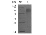 Recombinant Mouse IL-2RG/CD132 Protein (His Tag)