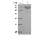 Recombinant Mouse IL-2RG/CD132 Protein (Fc Tag)