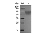 Recombinant Mouse IL2Ra/CD25 Protein (His Tag) Purity >95%