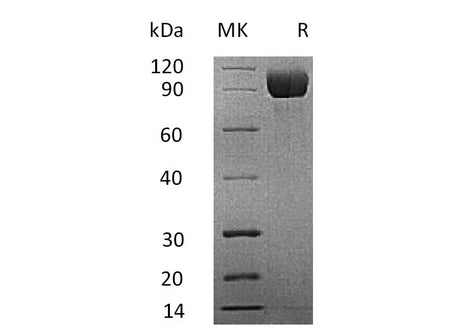 Recombinant Mouse IL13RA1 Protein (Fc Tag)