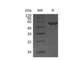 Recombinant Mouse Interleukin-11/IL-11 Protein (Fc Tag)