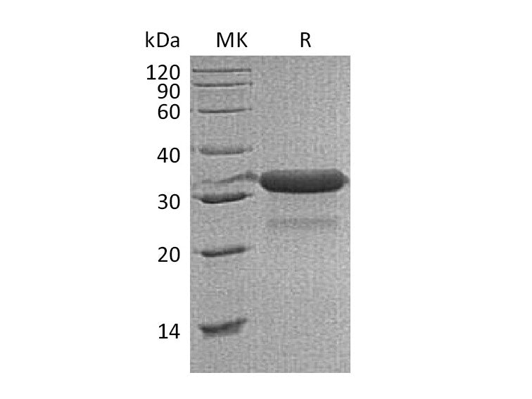 Recombinant Mouse IGFBP-7/IGFBP7 Protein (His Tag)