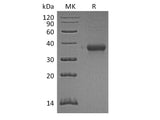 Recombinant Mouse IMPAD1/IMP3 Protein (His Tag)