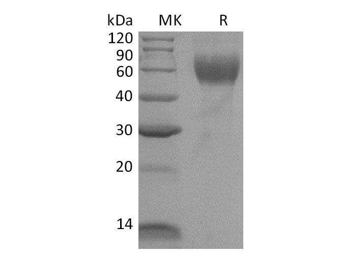 Recombinant Mouse IL1R1/CD121a Protein (His Tag)