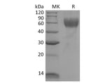 Recombinant Mouse IL1R1/CD121a Protein (His Tag)