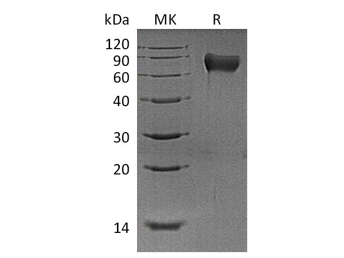 Recombinant Mouse Hemopexin/HPX Protein (His Tag)