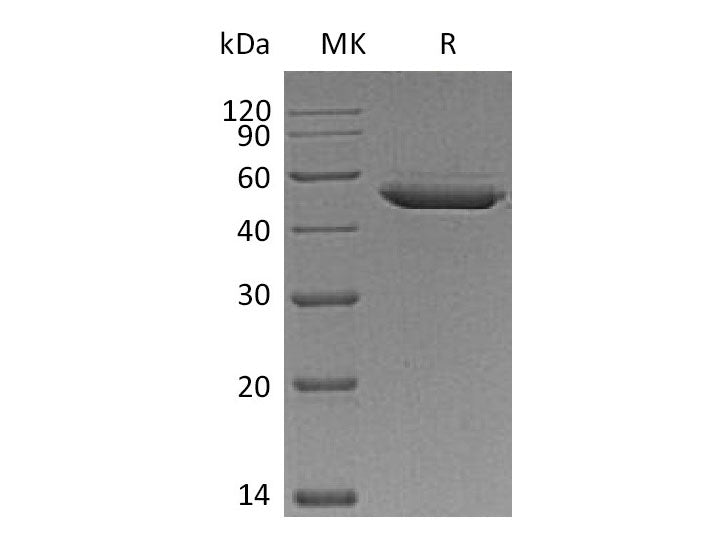 Recombinant Mouse SerpinE2/SERPINE2 Protein (His Tag)