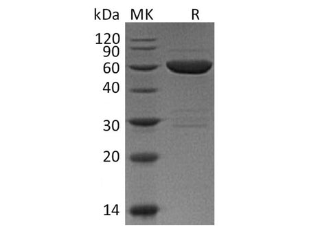 Recombinant Mouse Galectin 9/LGALS9 Protein (GST Tag)