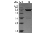 Recombinant Mouse Galectin 9/LGALS9 Protein (GST Tag)