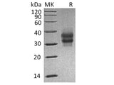 Recombinant Mouse FOLR1 Protein (aa 25-232, His Tag)