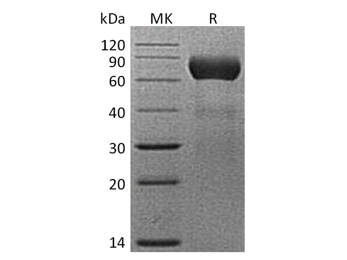 Recombinant Mouse NTPDase 2/ENTPD2 Protein (His Tag)