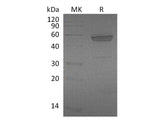 Recombinant Mouse EDA2R/TNFRSF27 Protein (Fc Tag)