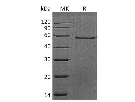 Recombinant Mouse Dermatopontin/DPT Protein (Fc Tag)