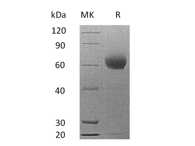 Recombinant Mouse Complement Factor H/CFH Protein (His Tag)