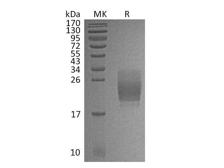 Recombinant Mouse CD160/BY55 Protein (His Tag)