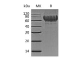 Recombinant Mouse Bone Sialoprotein 2/IBSP Protein (His Tag)