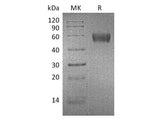Recombinant Mouse Apolipoprotein H/ApoH Protein (His Tag)(Active)