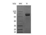 Recombinant Mouse CD38 Protein (Fc Tag)