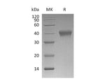 Recombinant Mouse CD38 Protein (His Tag)