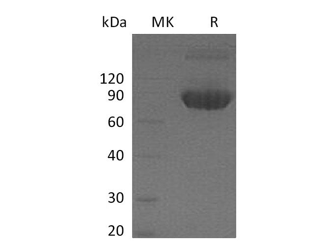 Recombinant Mouse CD80/B7-1 Protein (Fc Tag)
