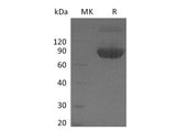 Recombinant Mouse CD80/B7-1 Protein (Fc Tag)