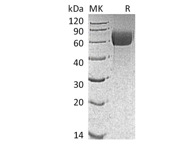 Recombinant Mouse IL13RA1 Protein (AVI & His Tag)