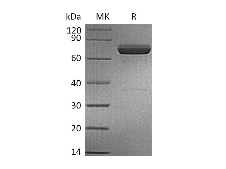 Recombinant Human IL-23 alpha & Mouse IL-12 beta Heterodimer (C-6His) Purity >95%