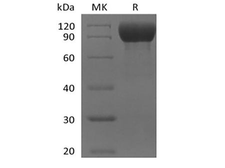 Recombinant Mouse IL-1 Receptor-Like 2/IL-1RL2/IL-1Rrp2/IL-36R (C-Fc)