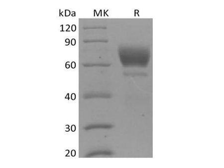 Recombinant Mouse Tyrosine-protein kinase receptor UFO/AXL oncogene/UFO (C-6His)