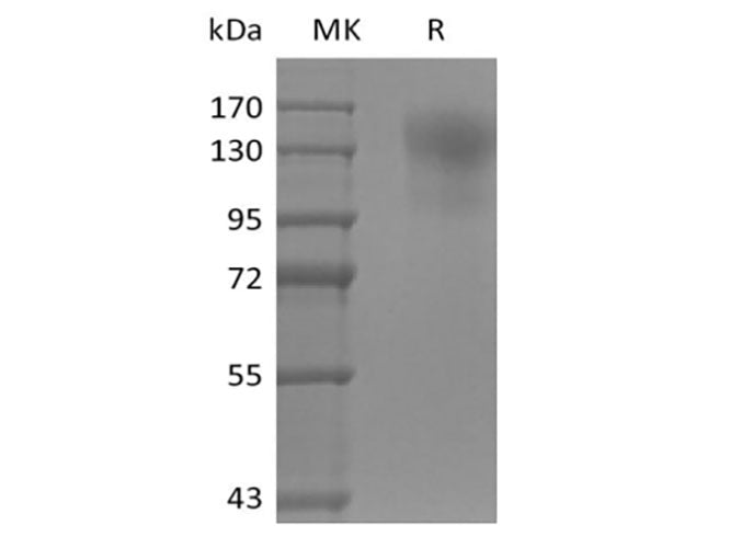 Recombinant Mouse CD45/PTPRC (C-6His)
