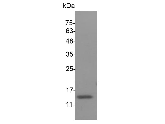 Recombinant Mouse IL-20 protein(N-His)(active)