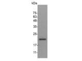 Recombinant Mouse IL-28B protein(N-His)(active)
