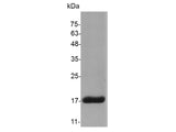 Recombinant Mouse IL-36 gamma protein(N-His)(active)