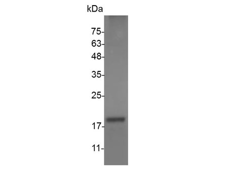 Recombinant Mouse FasL protein(N-His)(active)