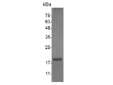 Recombinant Mouse FasL protein(N-His)(active)