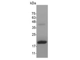 Recombinant Mouse Flt-3 Ligand protein(N-His)(active)
