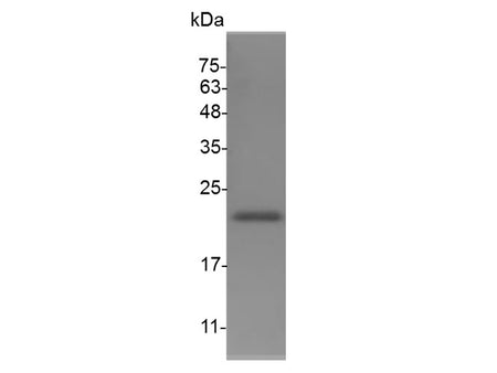 Recombinant Mouse G-CSF protein(N-His)