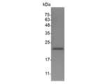 Recombinant Mouse G-CSF protein(N-His)
