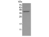 Recombinant Mouse HDGF protein(N-His)