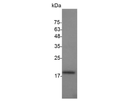 Recombinant Mouse VEGF121 protein(N-His)(active)