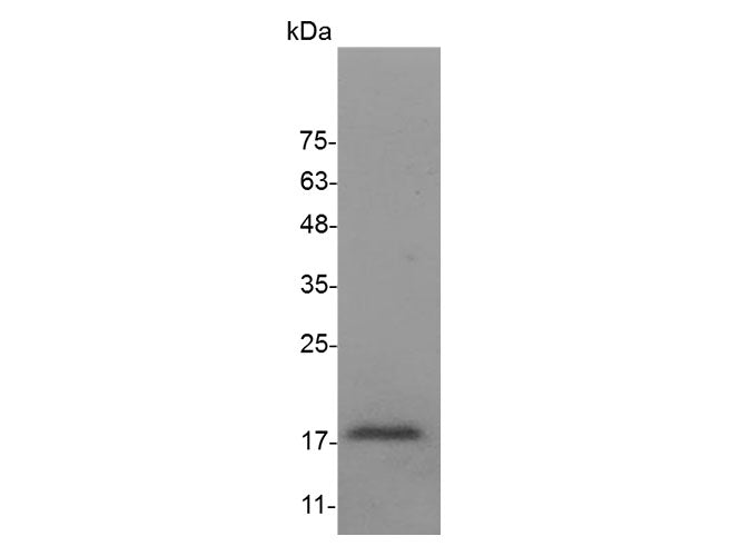 Recombinant Mouse CCL2 protein(N-His)(active)