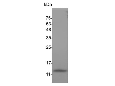 Recombinant Mouse CCL4 protein(N-His)(active)