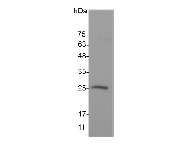 Recombinant Mouse IL-17D protein(N-His)