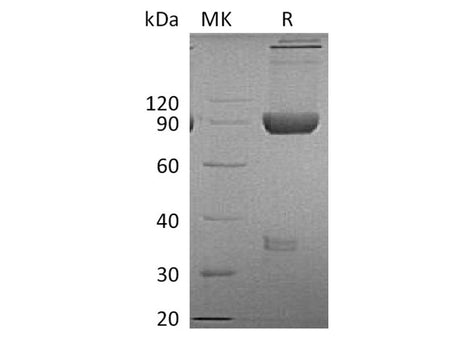 Recombinant Cynomolgus LAG-3/CD223 Protein (Fc Tag)