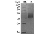 Recombinant Cynomolgus PD-L2/B7-DC/CD273 Protein (His Tag)