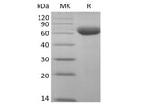 Recombinant Cynomolgus Sialic acid-binding Ig-like lectin 15/Siglec-15/CD33L3 (C-Fc)