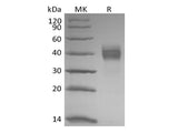Recombinant Rhesus Macaque Tumor-associated Calcium Signal Transducer 2/TROP-2 (C-6His)