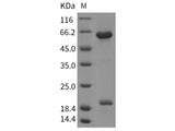 Recombinant Rat B7-H6/NCR3LG1 Protein (ECD, Fc Tag)(Active)